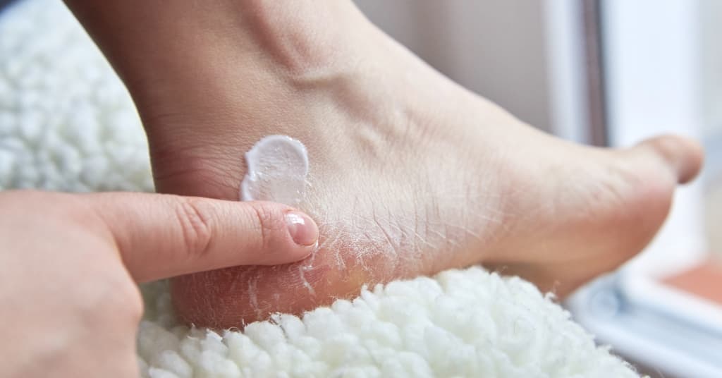 Foot Care Cream