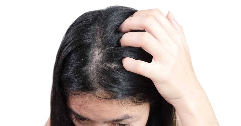 Expert Hair-Oiling Tips