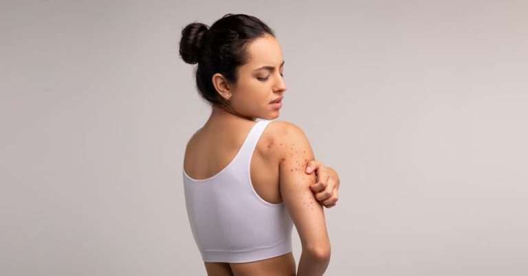 Acnetop Body Acne Solutions for Smooth and Healthy Skin