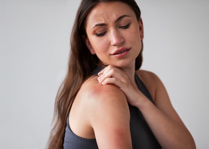 Body Acne Causes